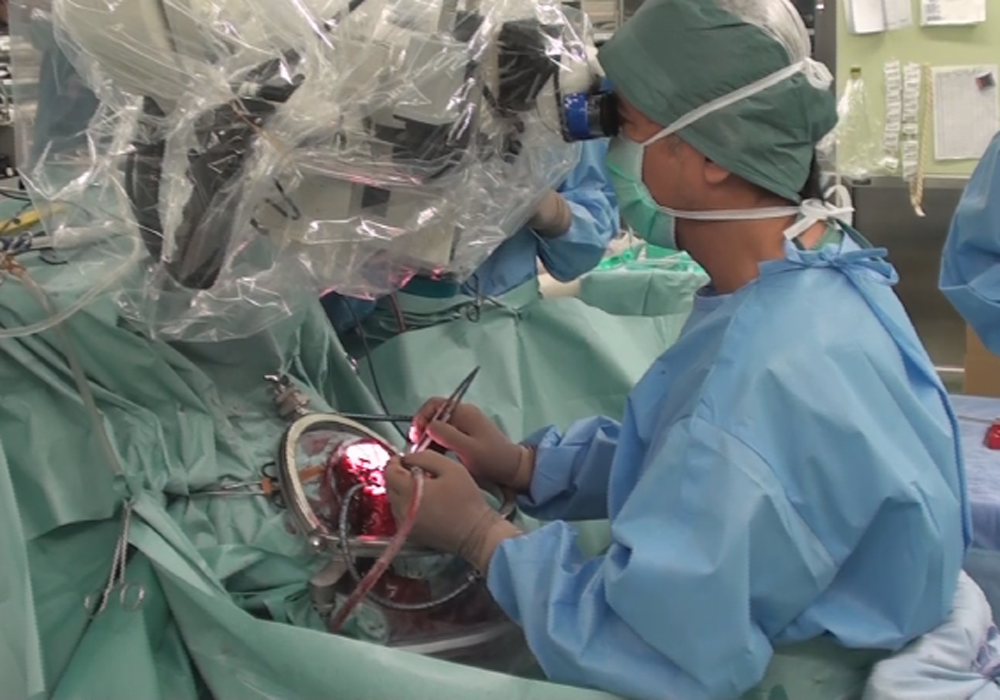 実際の手術の様子
提供：昭和大学医学部脳神経外科・水谷　徹先生