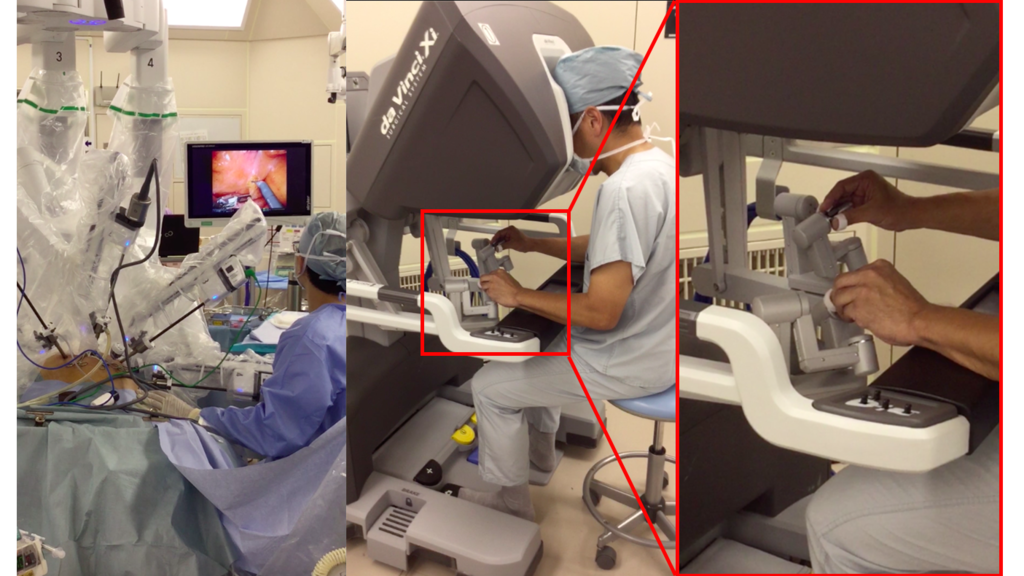 左端：手術台とロボット
中心：サージョンコンソールを使用したロボット操作部分
左：サージョンコンソールの拡大写真
画像提供：志田大先生