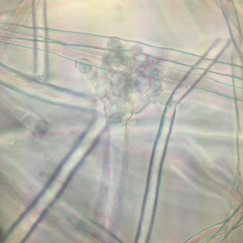 麹を顕微鏡で観察し、実際に胞子を観察することができました